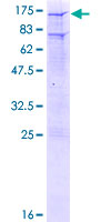 Recombinant Human Glucocorticoid Receptor protein