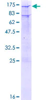SDS-PAGE - Recombinant Human Glucocorticoid Receptor protein (AB158585)