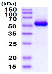 SDS-PAGE - Recombinant human Glucokinase protein (Active) (AB241320)
