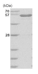 SDS-PAGE - Recombinant Human Glucokinase protein (His tag N-Terminus) (AB85977)