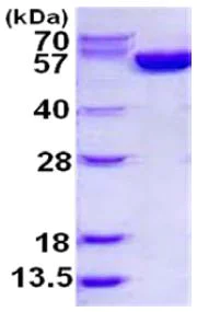 SDS-PAGE - Recombinant human Glucose 6 Phosphate Dehydrogenase protein (His tag N-Terminus) (AB126671)