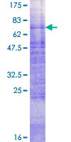 SDS-PAGE - Recombinant Human Glucose Transporter GLUT4 protein (GST tag N-Terminus) (AB159519)