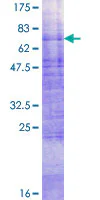 SDS-PAGE - Recombinant Human Glucose Transporter GLUT4 protein (GST tag N-Terminus) (AB159519)