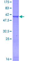 SDS-PAGE - Recombinant Human GLUD2 protein (GST tag N-Terminus) (AB132807)