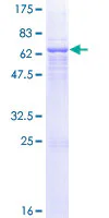 SDS-PAGE - Recombinant Human Glutaminyl cyclase protein (GST tag N-Terminus) (AB161786)