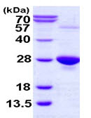 SDS-PAGE - Recombinant Human Glutathione Peroxidase 1 protein (His tag N-Terminus) (AB113603)