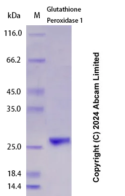 SDS-PAGE - Recombinant Human Glutathione Peroxidase 1 Protein Standard (His tag) (AB323071)