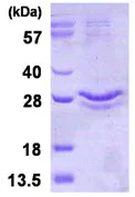 SDS-PAGE - Recombinant Human Glutathione Peroxidase 3/GPx-3 protein (His tag N-Terminus) (AB123158)