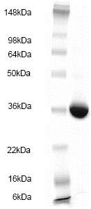 SDS-PAGE - Recombinant Human glutathione S transferase Omega 1/p28 protein (AB83020), expandable thumbnail
