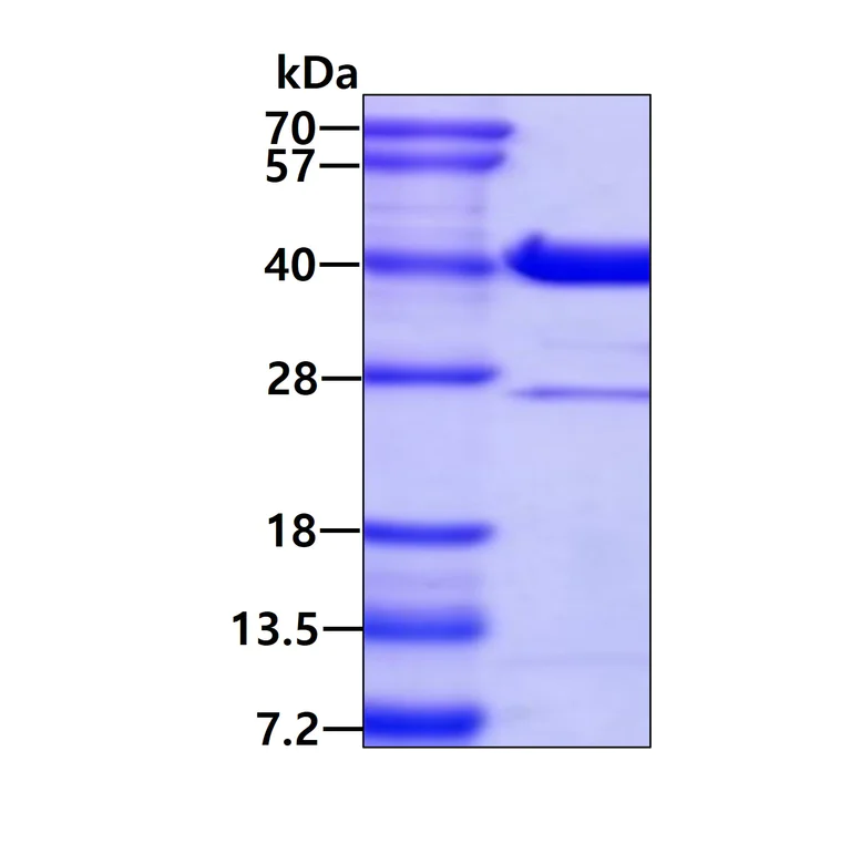 SDS-PAGE - Recombinant Human GLYAT/GAT protein (AB109928)