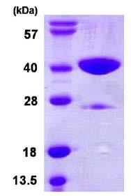 SDS-PAGE - Recombinant Human GLYAT/GAT protein (AB109928)