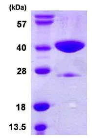 SDS-PAGE - Recombinant Human GLYAT/GAT protein (His tag N-Terminus) (AB109928)