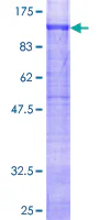 SDS-PAGE - Recombinant Human Glycogen synthase 1/GYS1 protein (GST tag N-Terminus) (AB158615)