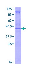 SDS-PAGE - Recombinant Human Glycophorin A protein (AB114330)