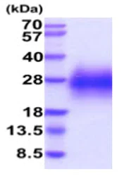 SDS-PAGE - Recombinant Human Glycophorin C/GPC protein (His tag C-Terminus) (AB219477)
