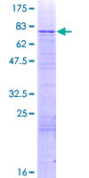 SDS-PAGE - Recombinant Human GLYR1 protein (AB164628)