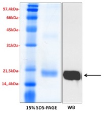 SDS-PAGE - Recombinant Human GM2A protein (His tag) (AB233610)