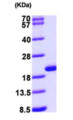 SDS-PAGE - Recombinant Human GMFB protein (AB99216)