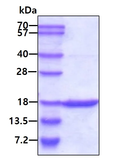 SDS-PAGE - Recombinant Human GMFG protein (Tag Free) (AB87412)