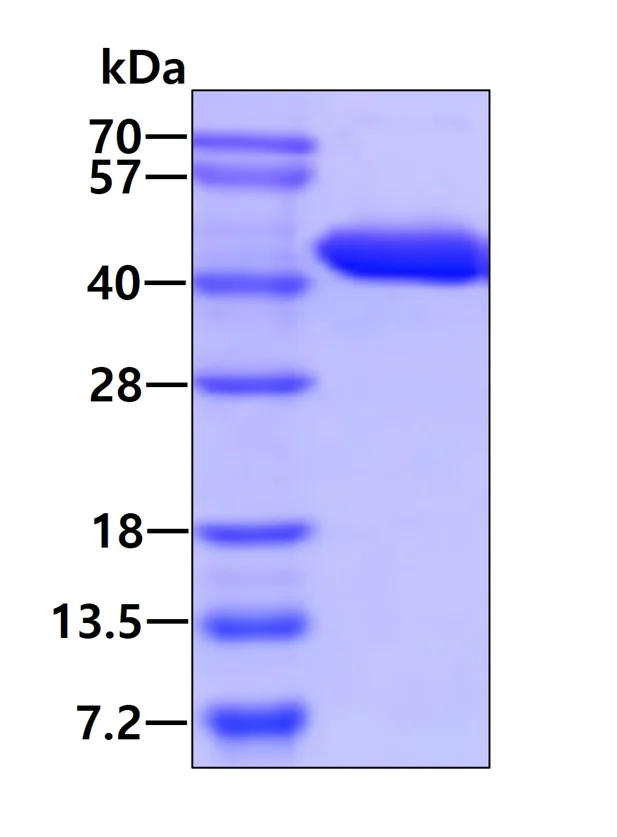 SDS-PAGE - Recombinant Human GNAI1 protein (His tag N-Terminus) (AB113585)