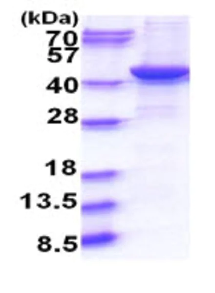 SDS-PAGE - Recombinant Human GNAQ protein (His tag) (AB264455)