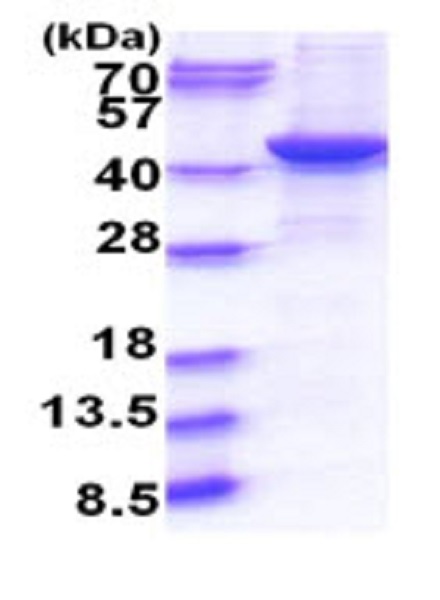 SDS-PAGE - Recombinant Human GNAQ protein (His tag N-Terminus) (AB264455)