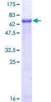 Recombinant Human GNAS protein