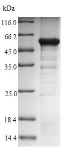 SDS-PAGE - Recombinant Human GNAZ protein (Tagged) (AB235560)