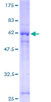 SDS-PAGE - Recombinant Human GNB1 protein (AB132818)