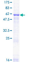 Recombinant Human GNB2 protein