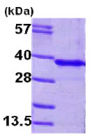 SDS-PAGE - Recombinant Human GNMT protein (AB79190)