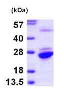 SDS-PAGE - Recombinant Human GNPNAT1 protein (His tag N-Terminus) (AB101942)