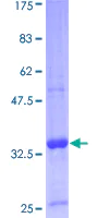 SDS-PAGE - Recombinant Human GnRH protein (AB112295)