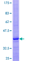 SDS-PAGE - Recombinant Human GNRH2 protein (AB158554), expandable thumbnail