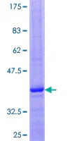 SDS-PAGE - Recombinant Human GNRH2 protein (AB158554)