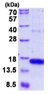SDS-PAGE - Recombinant Human GOLGA7 protein (His tag N-Terminus) (AB156974)