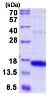 SDS-PAGE - Recombinant Human GOLGA7 protein (His tag N-Terminus) (AB156974)