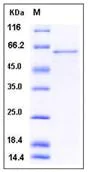 SDS-PAGE - Recombinant Human GOLPH2 protein (His tag) (AB276495)
