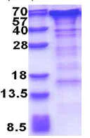 SDS-PAGE - Recombinant Human GOLPH2 protein (His tag N-Terminus) (AB176033)