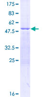 SDS-PAGE - Recombinant Human GOSR1/GS28 protein (AB160530)