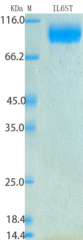 SDS-PAGE - Recombinant Human gp130 Protein Standard (His tag) (AB316485)