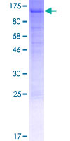 Recombinant Human GP210 protein