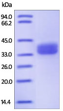SDS-PAGE - Recombinant Human GPA33 protein (His tag) (AB220468)