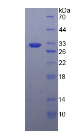 SDS-PAGE - Recombinant Human GPBB protein (Tagged) (AB275562)