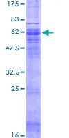 SDS-PAGE - Recombinant Human GPCR C5L2 protein (GST tag N-Terminus) (AB153291)