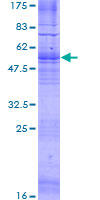 SDS-PAGE - Recombinant Human GPCR GPR12 protein (AB116876)
