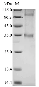 SDS-PAGE - Recombinant Human GPCR GPR146 protein (AB289774)