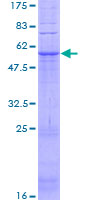 SDS-PAGE - Recombinant Human GPCR GPR31 protein (GST tag N-Terminus) (AB158567)
