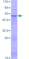 SDS-PAGE - Recombinant Human GPCR GPR31 protein (GST tag N-Terminus) (AB158567)