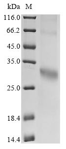 SDS-PAGE - Recombinant human GPCR GPR35 protein (His tag) (AB314525)